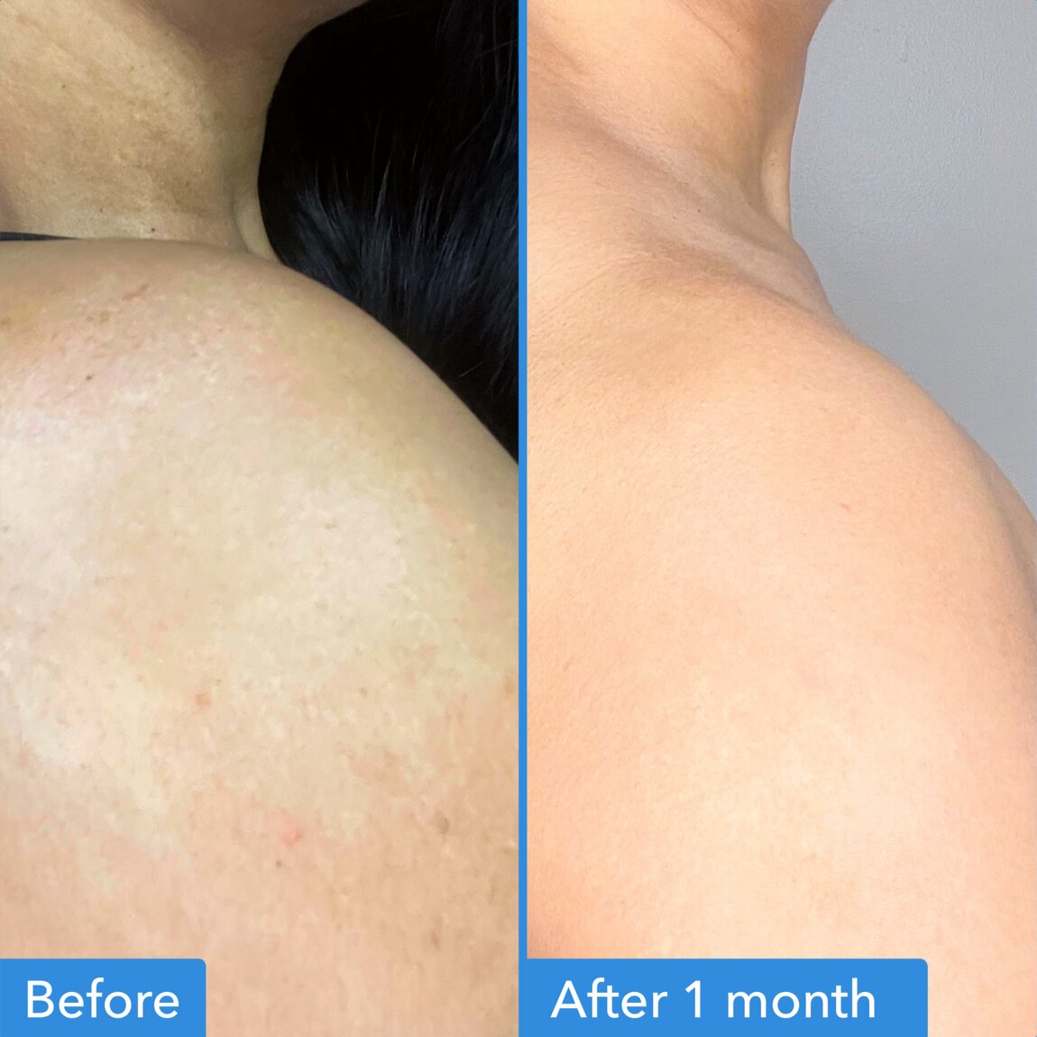 discoloration-correcting-body-treatment-j8 zb_p.jpg