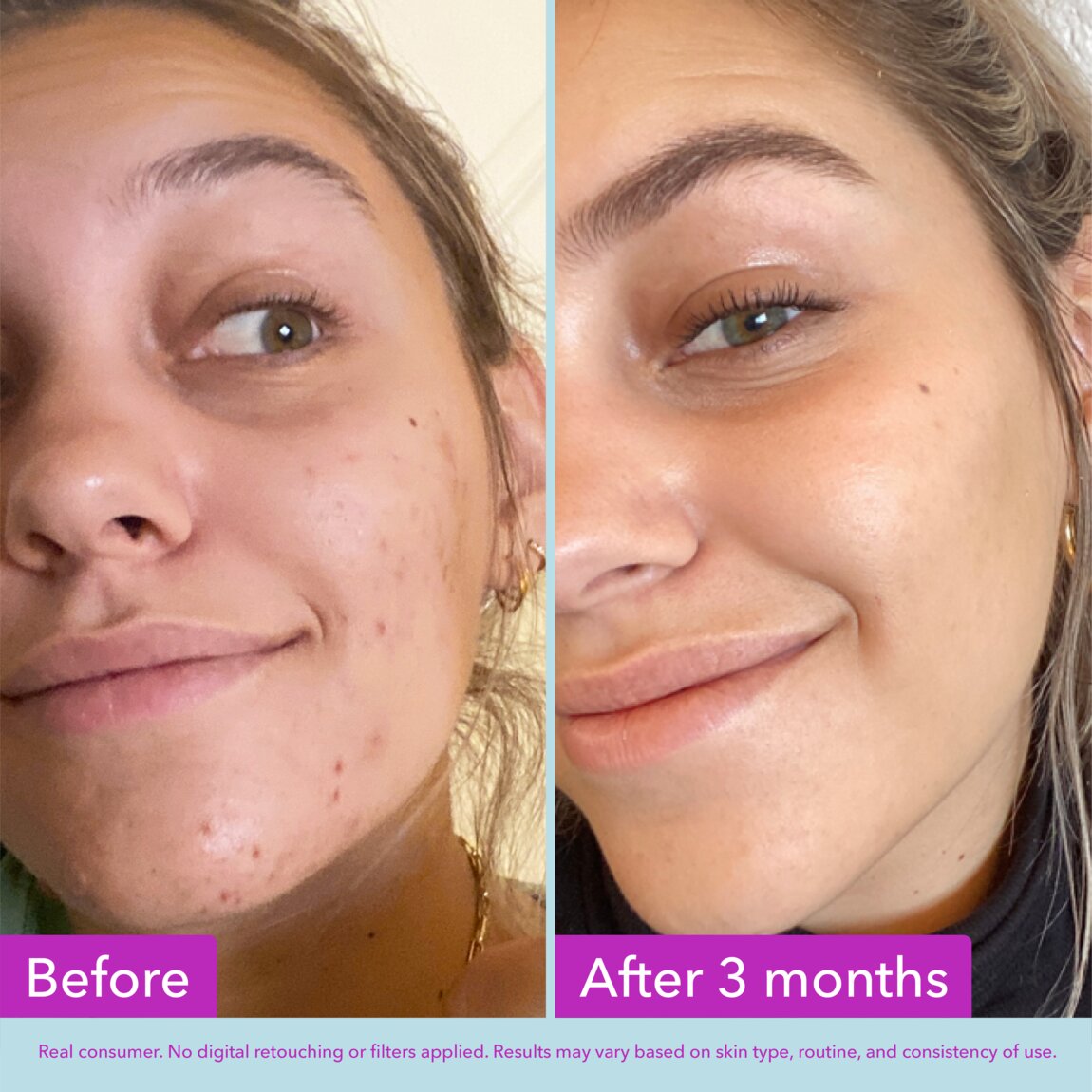 niacinamide-brightening-toner-d5 zb_p.jpg