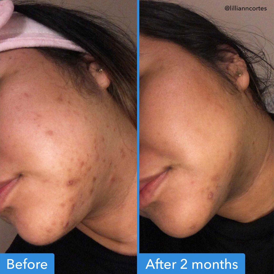 discoloration-correcting-serum-w1 zb_p.jpg